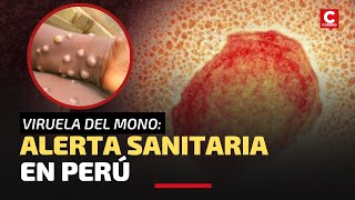 VIRUELA DEL MONO EN PERÚ ¿Por qué se declaró una alerta sanitaria [upl. by Nosreip]