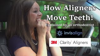 How aligners like Invisalign move teeth  Time lapse explained [upl. by Georgine]