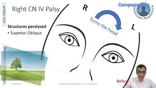 Trochlear Nerve [upl. by Otreblig]