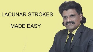 LACUNAR STROKES MADE EASY [upl. by Bautram]