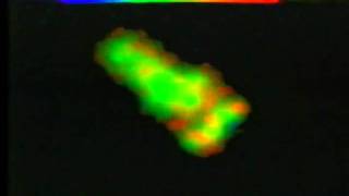 Chemotaxis and Phagocytosis in Human Neutrophils [upl. by Esiole]