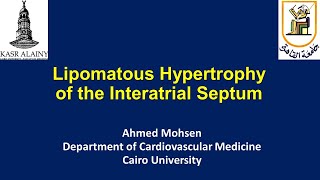 Lipomatous hypertrophy of the Interatrial Septum Lipomatous atrial septal hypertrophy LASH [upl. by Row807]