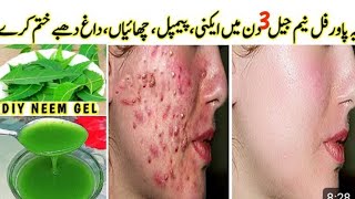 Neem Ka powder remedy by mahlain dany pimple ko jad sy khatm kry [upl. by Tlok]