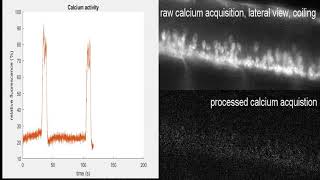 Neuroday 2019 calcium imaging [upl. by Akinahc292]