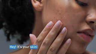 Clear Acne and Prevent New Breakouts │ CeraVe Skincare [upl. by Akinnor876]