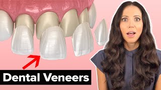 Dental Veneers Procedure Explained [upl. by Lorain93]