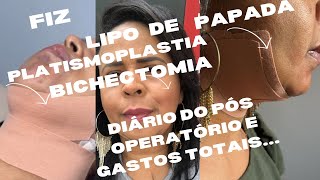 DIÁRIO DOS PÓS OPERATÓRIO LIPO DE PAPADA PLATISMOPLASTIABICHECTOMIA E GASTOS TOTAIS [upl. by Damle119]