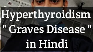 Hyperthyroidism quotGraves Diseasequot In Hindi Language  😊😊 [upl. by Einafets374]