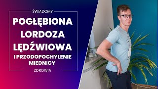 Pogłębiona lordoza lędźwiowa i przodopochylenie miednicy Co z tym zrobić i jak ćwiczyć [upl. by Eteragram]