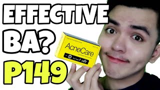 AcneCare Soap Review  BYE PIMPLES NA BA [upl. by Rolland]