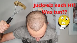 Juckreiz der Kopfhaut nach Haartransplantation Was tun [upl. by Witha]