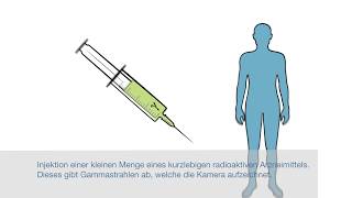 Nuklearmedizinische Untersuchung  Institut für Radiologie und Nuklearmedizin – Stadtspital Triemli [upl. by Ettelrats217]