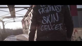 REBEL AGAINST SKIN CANCER Campaign Teaser [upl. by Vevay582]