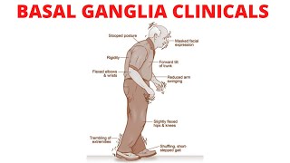 The Basal Ganglia Clinical Anatomy  Parkinson’s Disease  Chorea  Huntington Disease [upl. by Etteiluj16]