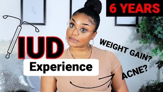 Honest IUD Experience⎜6 Years w IUD Mirena  Part 1 [upl. by Aserat888]