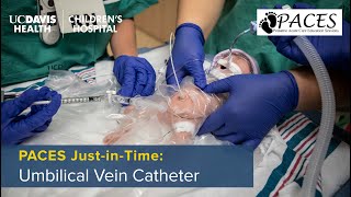 PACES JustinTime Umbilical Venous Catheter UVC Placement [upl. by Darcey]