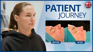 Natalies Rhinoplasty Journey [upl. by Greggory]