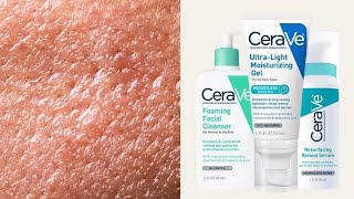 Top 5 CeraVe Skincare for Oily  Combination Skin Types [upl. by Halda438]