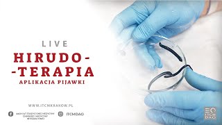 18 Hirudoterapia  Aplikacja Pijawki Jak postawić pijawkę  Live z kursu [upl. by Bena]