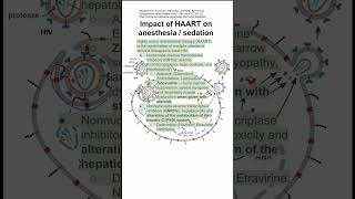 Impact of HAART on anesthesia  sedation [upl. by Ziladnerb]