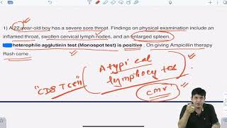 INFECTIOUS MONONUCLEOSIS  PSEUDOMEMBRANE  CASE STUDY [upl. by Aneehc]