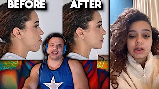 Tyler1 Macaiyla After Jaw Surgery [upl. by Raknahs797]