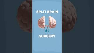 Can you split consciousness  science neuroscience experiment [upl. by Labors972]