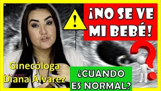 ⚠SACO GESTACIONAL SIN BEBÉ❗ ¿Hasta cuando es NORMAL❓ por GINECOLOGA DIANA ALVAREZ [upl. by Senskell]