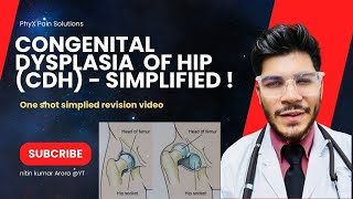 Barlow amp Ortolani test Congenital Hip Dislocation Everything You Need To Know  Dr Ishant Arora [upl. by Notna]