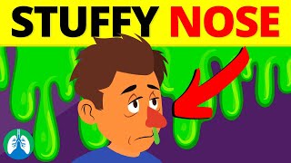 7 Ways to Clear a Stuffy Nose Nose Unblocking Techniques [upl. by Naesyar]