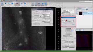 Fluorescence imaging with the ApoTome [upl. by Nnaeerb]