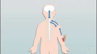 Pathophysiology of Pain by C Dowling  OPENPediatrics [upl. by Eigger]