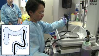 Colonoscopy What is a colonoscopy procedure [upl. by Airtened]