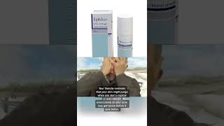 Acne treatment with Roaccutane Isotretinoin [upl. by Ezana]