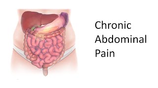 An Approach to Chronic Abdominal Pain [upl. by Asilrahc]