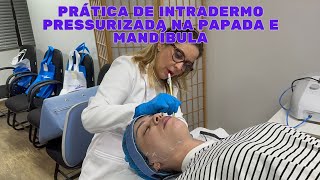 PRÁTICA DE INTRADERMO PRESSURIZADA NA PAPADA E MANDÍBULA [upl. by Gorman715]