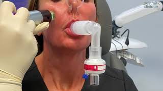 Hyperdilute Radiesse Neck Injections And RF Microneedling Dr Weiner’s triNECKta [upl. by Prissy519]