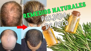 Remedios naturales y caseros para la perdida de pelo🌿 [upl. by Bekah]