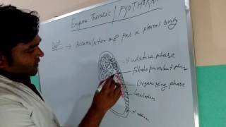 PyothoraxEmpyema thoracis Lecture hand drawn [upl. by Rehprotsirhc116]