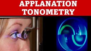 Applanation Tonometry  how to do goldmann applanation tonometry [upl. by Tooley147]