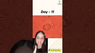 Welcome to today’s Micro Mystery  Can you crack this case  Day 11  Dr Devyani Puri [upl. by Leahcimluap]