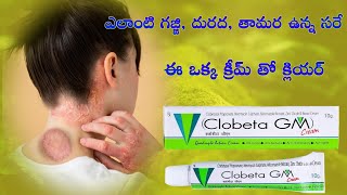 Clobeta GM cream uses in telugu  anti bacterial cream  antifungal cream  skin infection [upl. by Nuahsyt407]