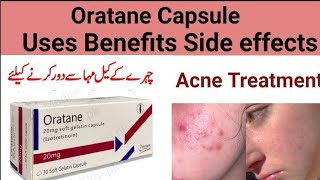 oratane capsule uses in Urdu hindi l Isotretinoin use side effects [upl. by Nohshan]