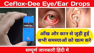 CefloxDee eye dropCefloxDee Ear dropCiprofloxacin amp Dexamethasone EyeDear drops [upl. by Aneehsal497]