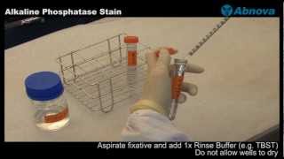 Alkaline Phosphatase Stain [upl. by Eednam968]