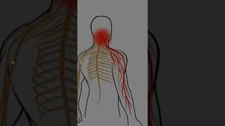 cervical spondylitis special test spurlings testtrending trendingshorts shortsfeed trend [upl. by Luapnaej34]