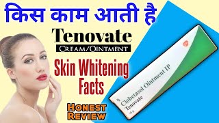 Tenovate Cream Kis Kaam Aati Hai  Tenovate Cream For Face  Clobetasol Cream For Skin Whitening [upl. by Delmer]