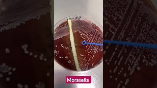 Microbiology lab diagnosis of Moraxella intact colonies [upl. by Farmann274]