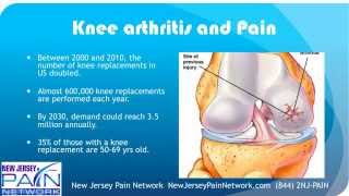 Knee Injections for Arthritis at New Jersey Pain Centers 844 2NJPAIN [upl. by Ilana]