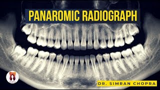 Panoramic Radiography l Focal Trough in Panoramic Radiography l Extraoral Radiography l OPG [upl. by Aidyl]